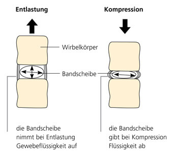 grafik bandscheiben trampolin-shop